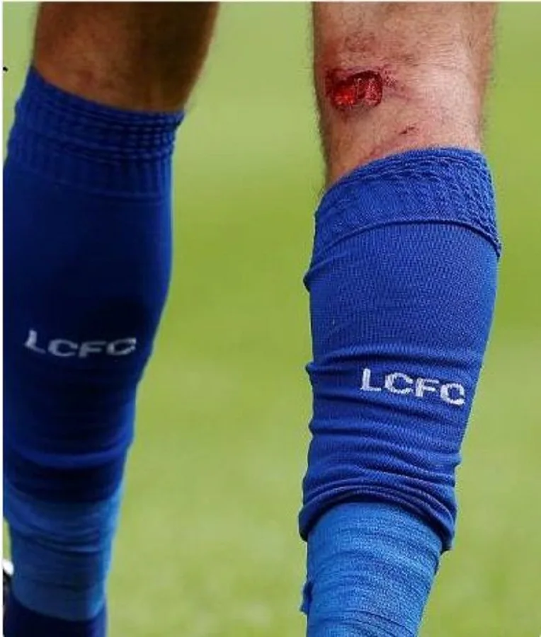 Islam Slimani se blesse avec Leicester