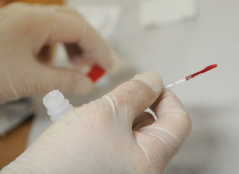 Sida : l’Algérie progresse en matière de dépistage et d’accès au traitement