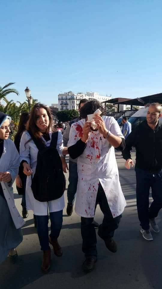 médecins résidents violemment agressés par la police le mercredi 03 janvier 2018 à Alger Blessé