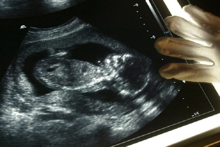 Un enfant algérien parmi les porteurs d’une maladie rare découverte en Suisse