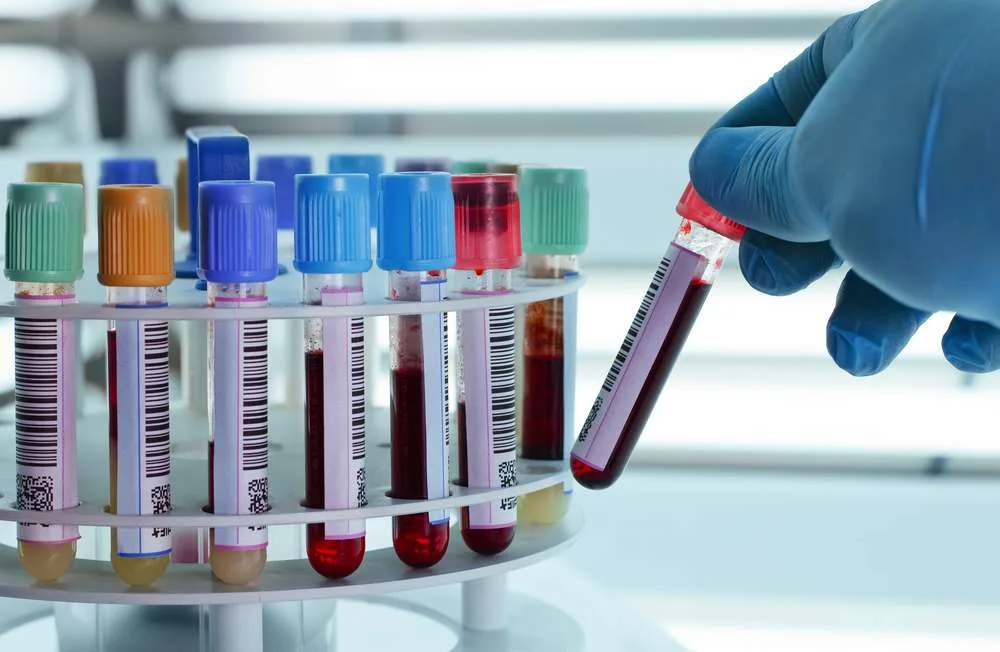 Covid-19 : les contaminations toujours en baisse en Algérie