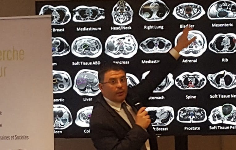 Montpellier : l’Intelligence artificielle en soutien de la lutte contre le cancer