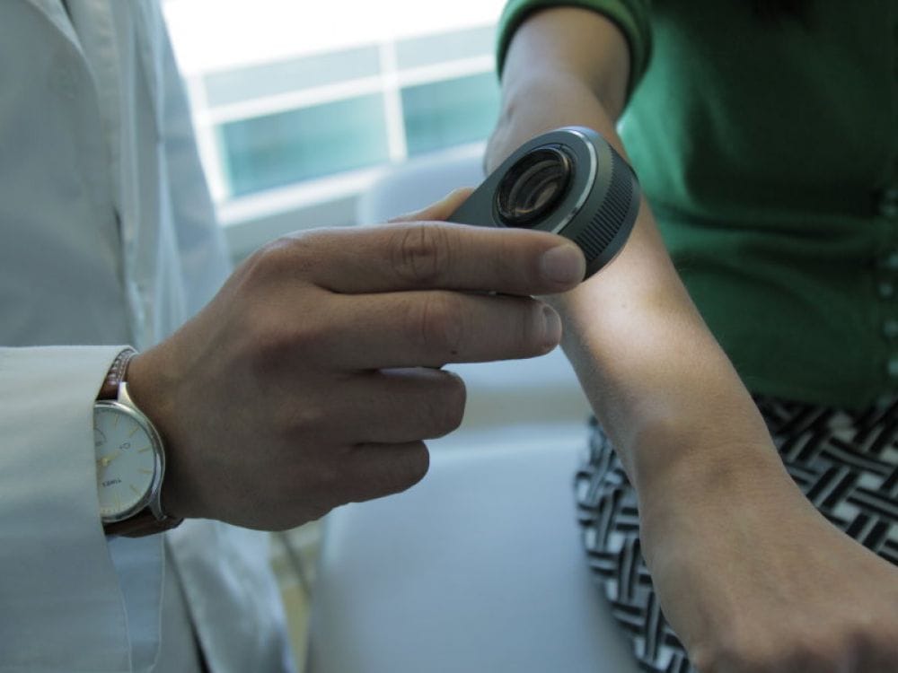 Santé : un ordinateur meilleur que les dermatologues pour repérer les cancers