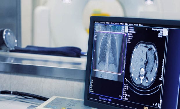 Des avancées porteuses d’espoir dans le traitement du cancer