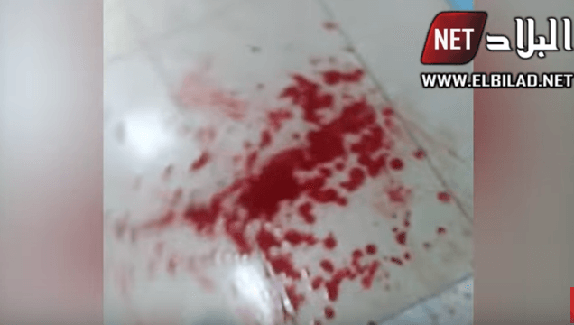 VIDÉO. Violents affrontements aux urgences de l&rsquo;hôpital de Douera