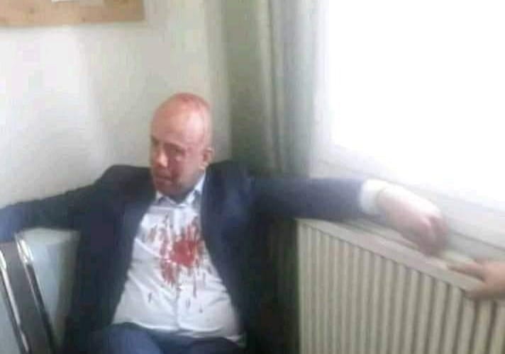 Le président de la JSK blessé à l’arme blanche