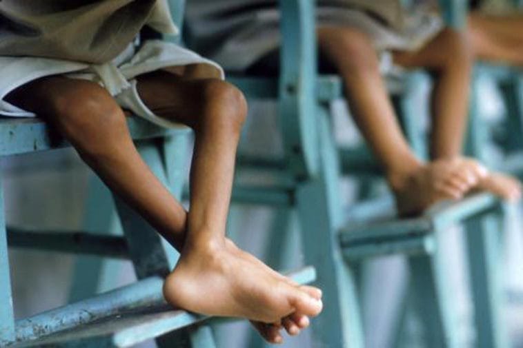 Les enfants dénutris, le douloureux visage de la crise au Venezuela