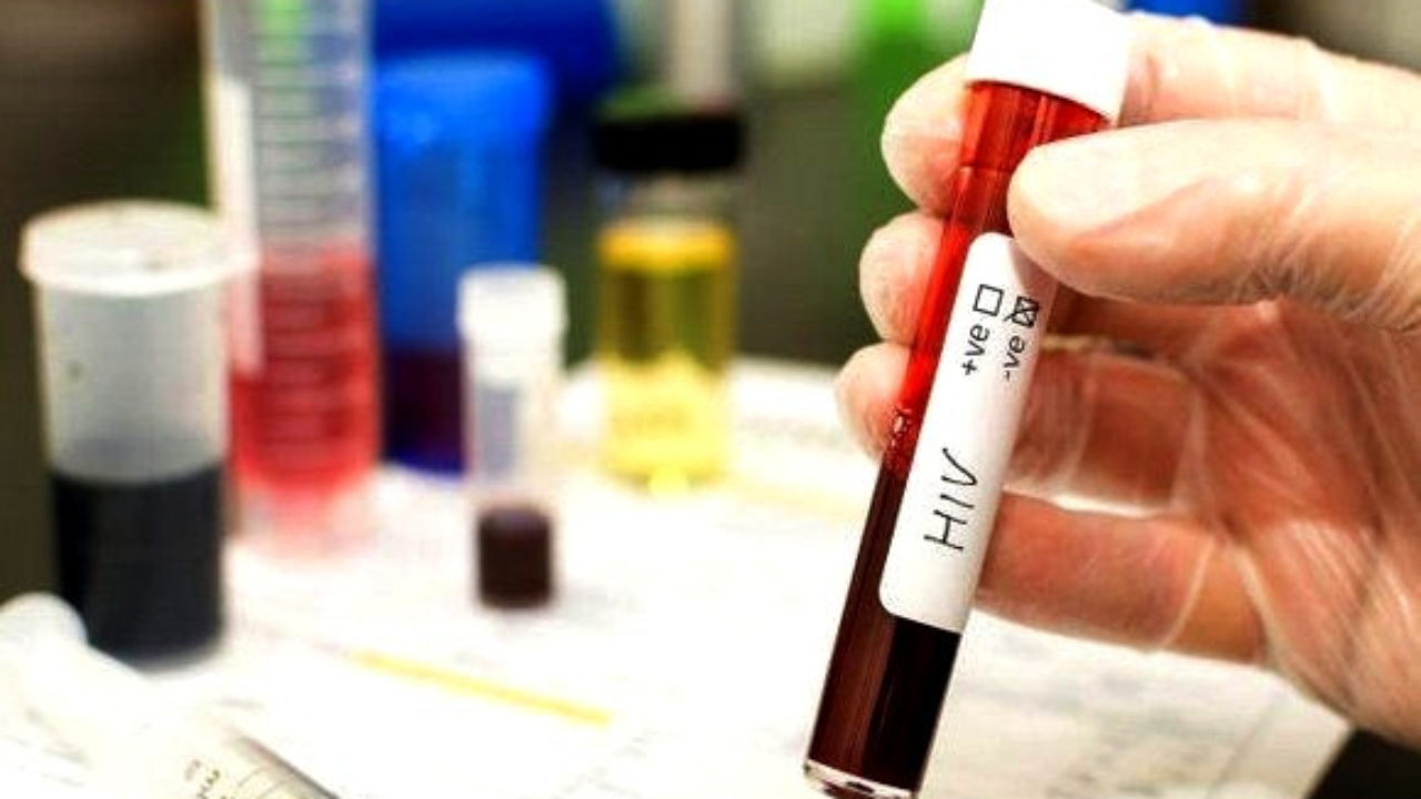 SIDA : 175 nouveaux cas enregistrés à Alger en six mois