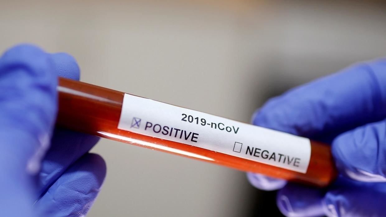 Nouveau bilan du coronavirus en Algérie : 302 cas confirmés dont 21 décès