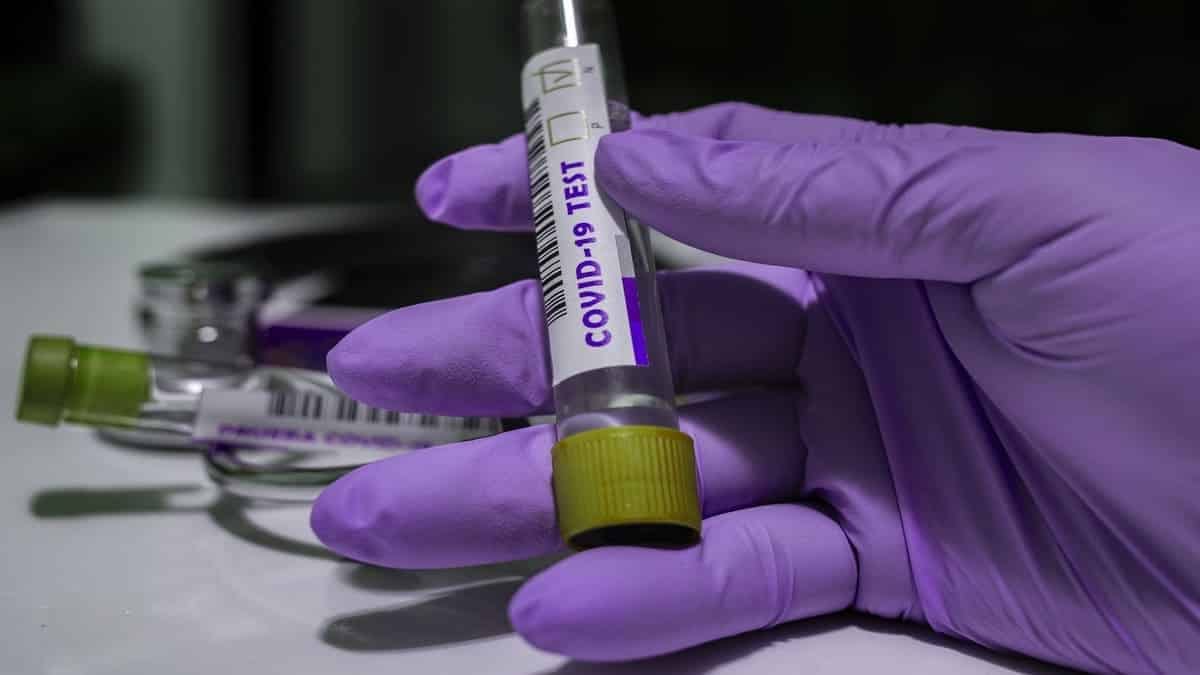 L&rsquo;humoriste Hakim Dekkar atteint du coronavirus