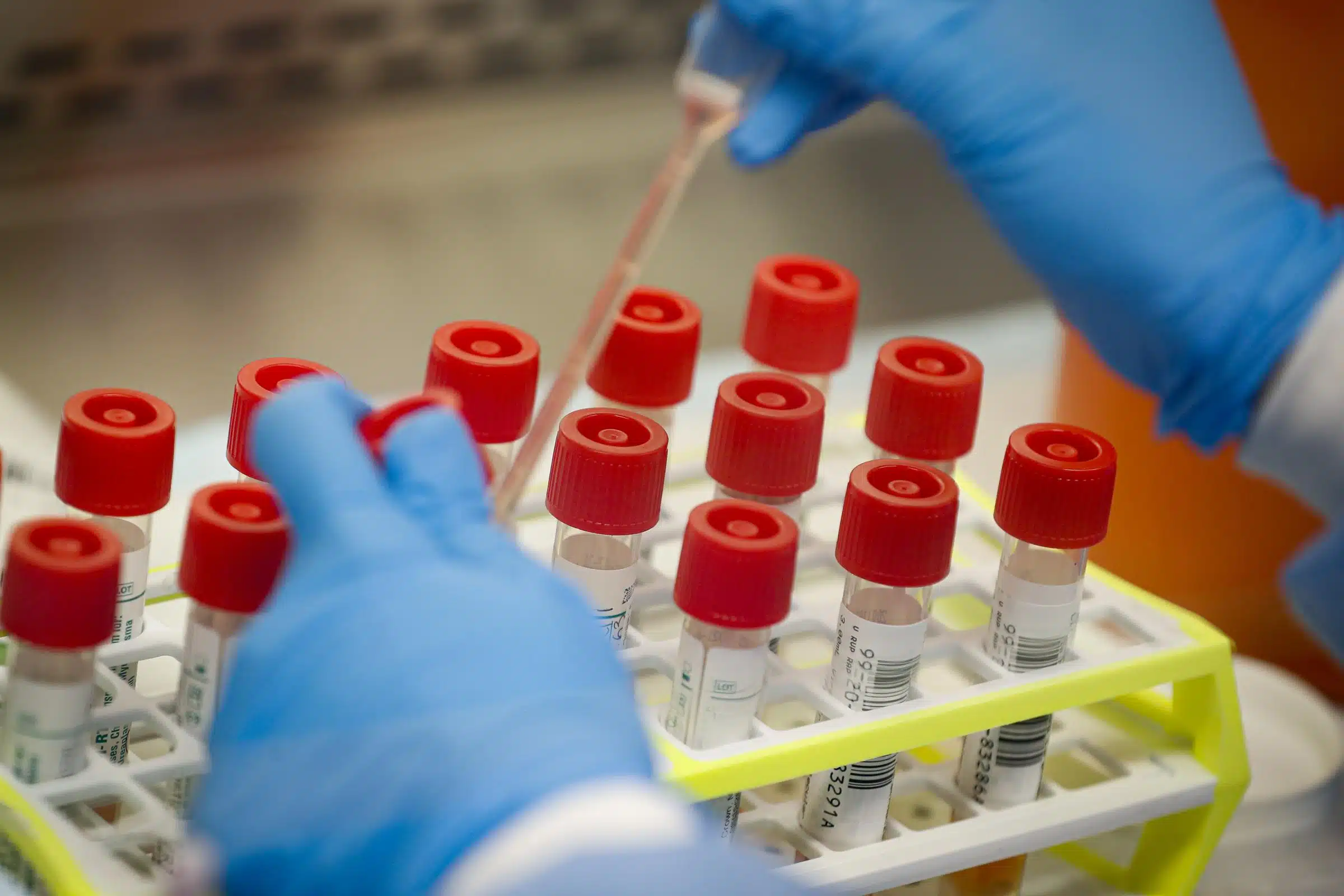 Coronavirus en Algérie : les contaminations en baisse, 1100 morts au total