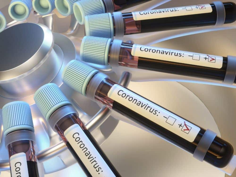 « On ne sait pas quelle est la part du variant dans le virus qui circule en Algérie »
