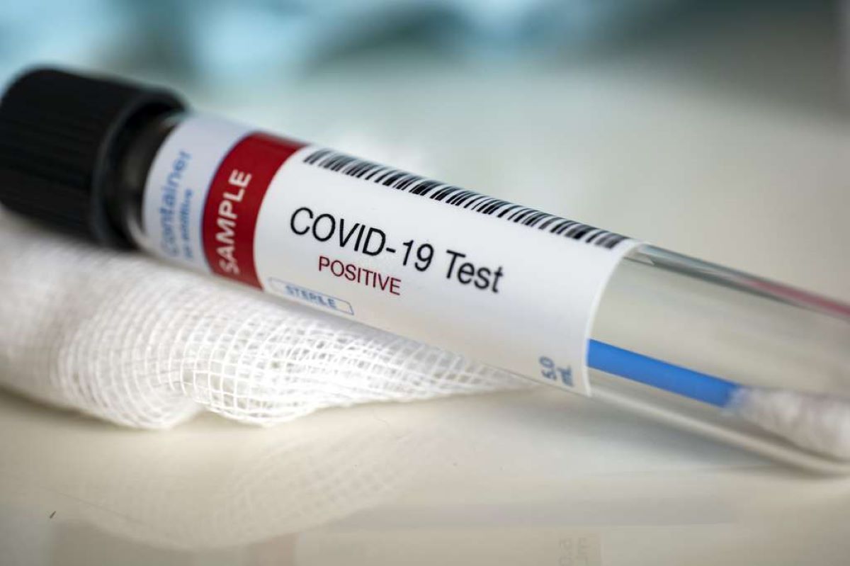 Tests Covid-19 : les conditions de remboursement partiel ...