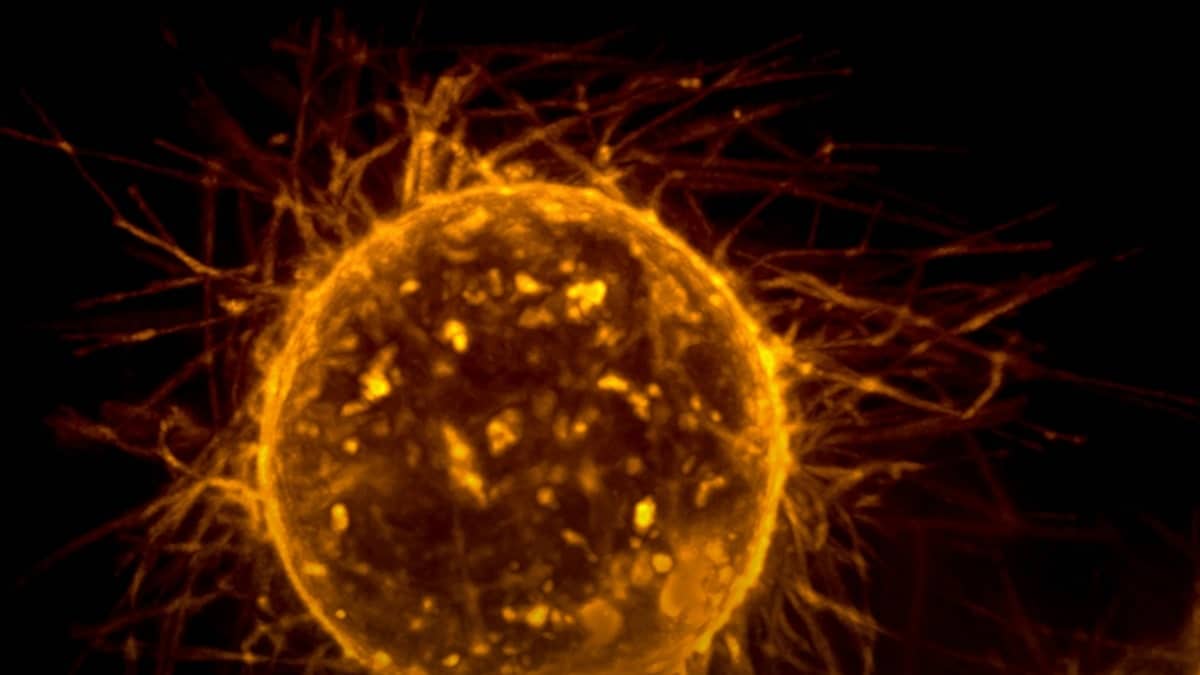 Melissa Saichi, une jeune chercheuse algérienne primée en France pour ses travaux sur le cancer