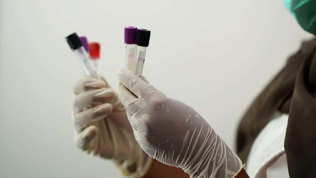 Recrutement en Algérie : les tests antidrogues entrent en vigueur