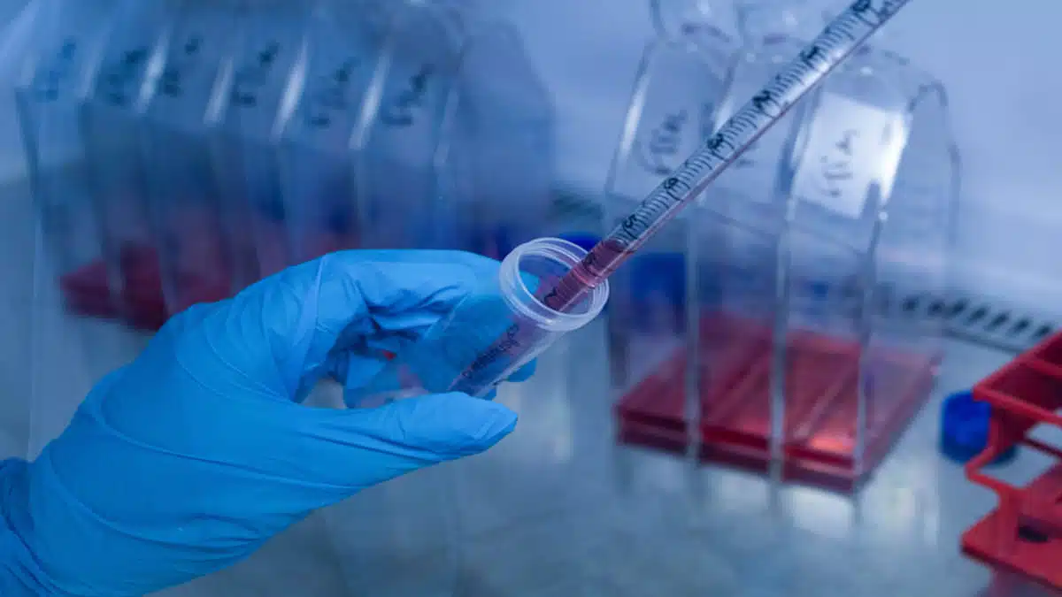 Hantavirus : une spécialiste franco-algérienne en première ligne